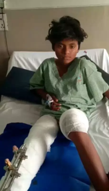 Pune IT Professionals Rally to Save Teen's Leg After Horrific Accident