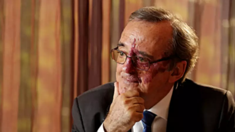 Spanish Scientist's Pancreatic Cancer Breakthrough Faces Funding Crisis