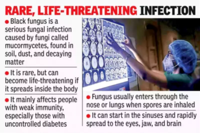 Study Reveals Oxidative Stress Drives Severe Tissue Damage in Black Fungus