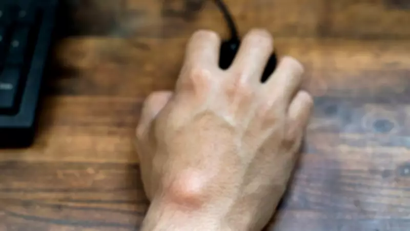 Why You Should Never Ignore Body Lumps: Expert Warns of Hidden Health Risks