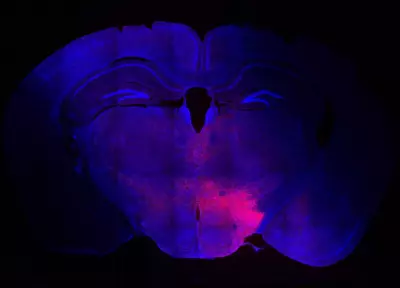 Bengaluru Scientists Discover Brain Circuit That Suppresses Itching During Stress