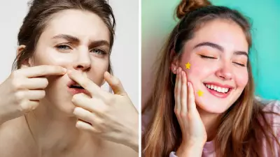 Pimple Patches: Dermatologist Reveals If They're Effective or Just Hype