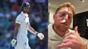 Ben Stokes Reveals Facial Injury After Cricket Ball Strike in Training