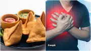 Daily Rs 20 Samosa Could Lead to Rs 3 Lakh Heart Surgery Bill, Warns Cardiologist