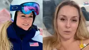 Lindsey Vonn Shares Hopeful Update After Olympic Crash, Details Leg Fracture and Surgeries