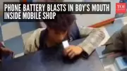 Mobile Shop Battery Explosion: Boy Injured After Chewing Lithium Battery