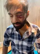 Mumbai Train Assault: GRP Arrests Labourer After Stone Attack Blinds Bystander