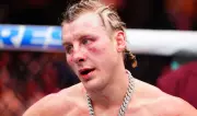 Paddy Pimblett Laughs Off UFC 324 Defeat, Eyes Gaethje Rematch