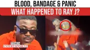 Ray J's Blood-Dripping Eyes at Concert Spark Health Fears and Viral Concern