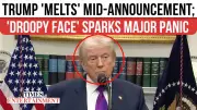 Trump's Facial Droop in Viral White House Clip Fuels Health Speculation