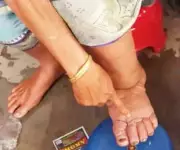 Union Health Minister Nadda Launches Mass Drug Drive Against Filariasis in Jharkhand