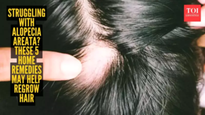 5 Proven Home Remedies for Hair Regrowth in Alopecia Areata