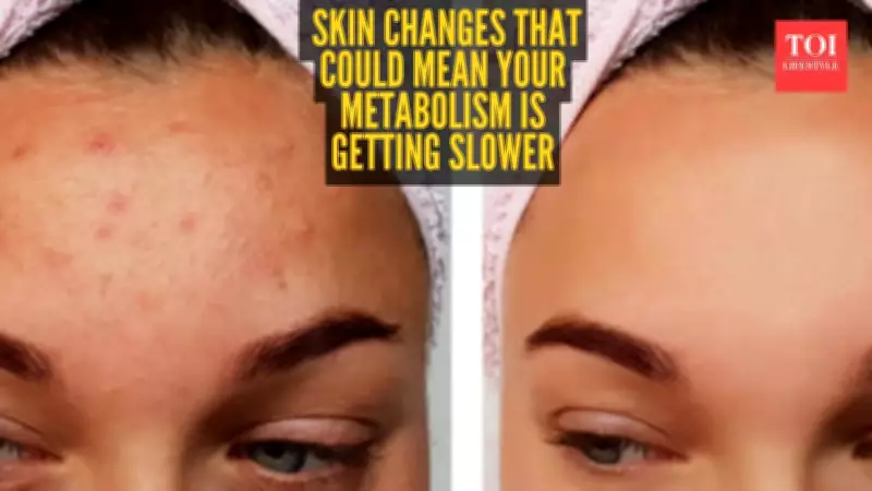 5 Skin Signs That Indicate Your Metabolism Is Slowing Down