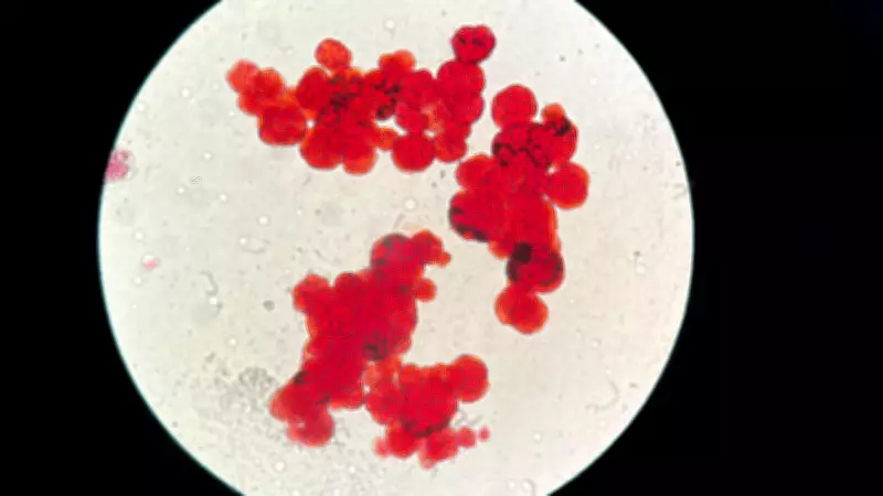 Ancient Sheep DNA Reveals 4,000-Year-Old Plague Origins, Shedding Light on Early Pandemics