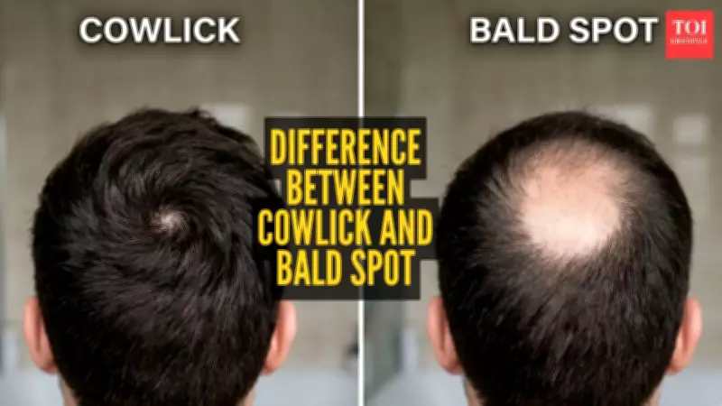 Cowlick vs Bald Spot: How to Tell the Difference and Stop Panicking