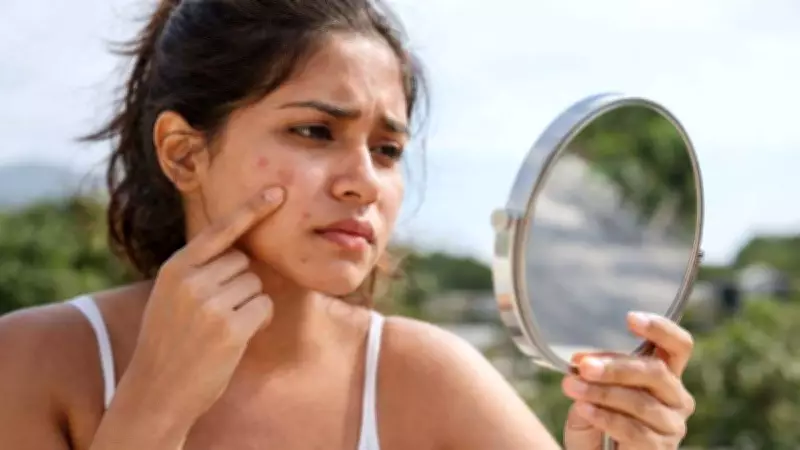 Dermatologist-Approved Summer Acne Treatment Guide for 2026