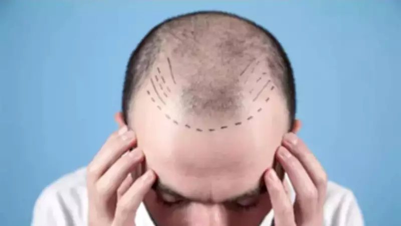 Doctors Demand National Regulations for Hair Transplant and Cosmetic Clinics