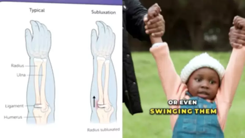 Doctor's Viral Instagram Reel Educates Parents on Common Child Arm Injury