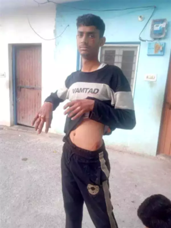 Himachal Teenager Fights Off and Kills Leopard in Terrifying Morning Attack