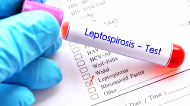 Karnataka Economic Survey Reveals Alarming Rise in Leptospirosis Cases
