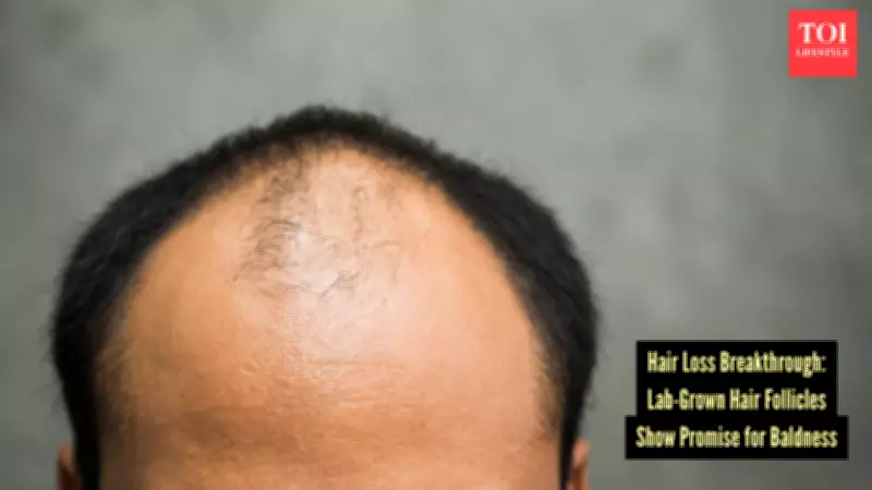 Lab-Grown Hair Follicles: A Potential Cure for Baldness on the Horizon?