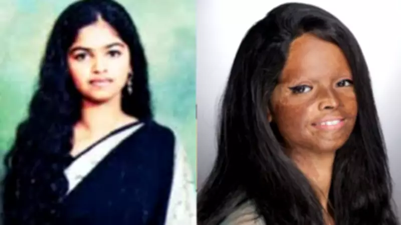Laxmi Agarwal: From Acid Attack Survivor to National Symbol of Courage and Change