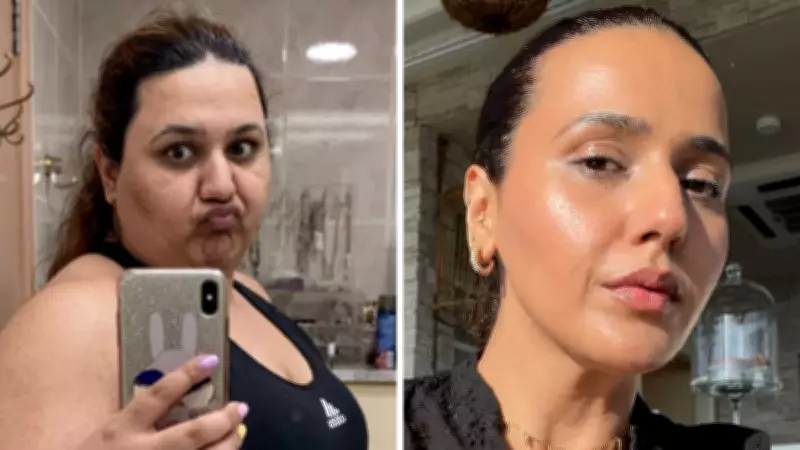 PCOS Reversal and Weight Loss: Lifestyle Changes Lead to Dramatic Skin Transformation