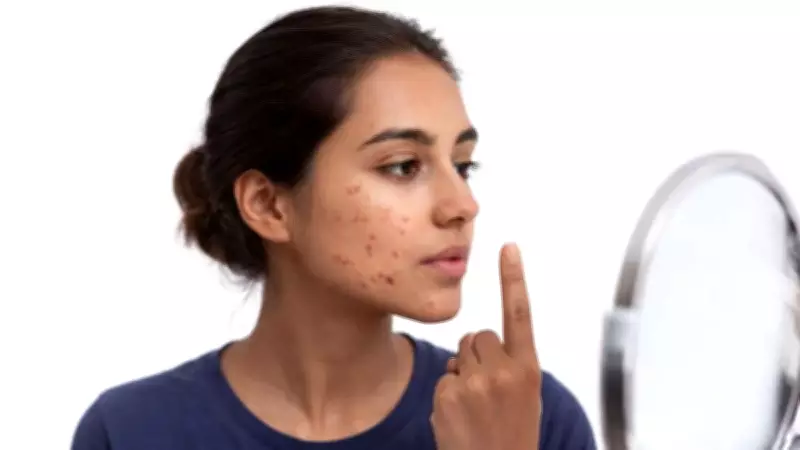 PCOS Symptoms Explained: Acne, Facial Hair, Irregular Periods, and More