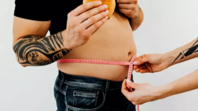 World Obesity Day 2026: Doctors Outline Preventive Measures to Combat Silent Killer