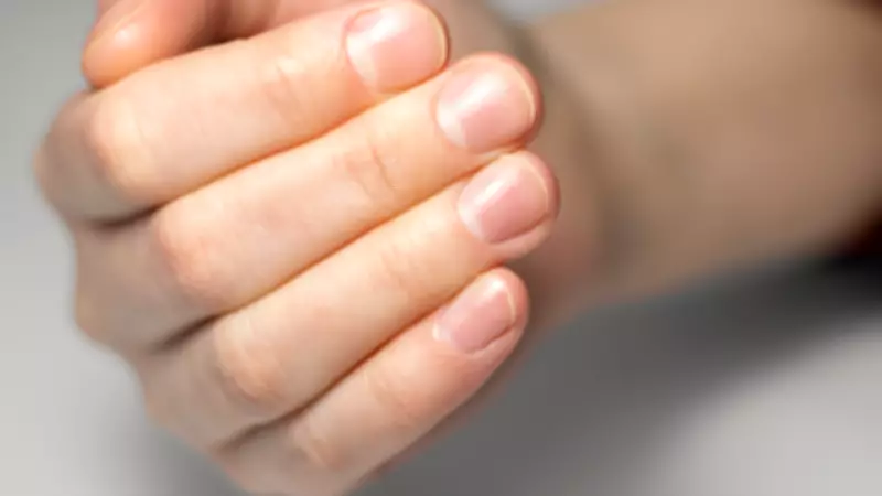 Your Nails as Health Indicators: From Iron Deficiency to Lung Disease