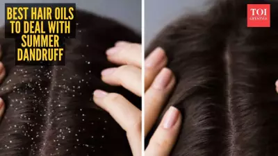 5 Best Hair Oils to Combat Summer Dandruff Naturally