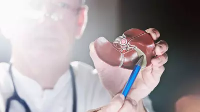 Diabetics Face Higher Risk of Severe Gallstone Complications, Warns Expert