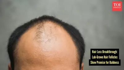 Lab-Grown Hair Follicles: A Potential Cure for Baldness on the Horizon?