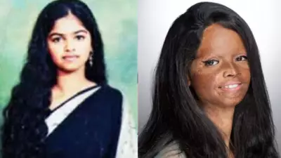 Laxmi Agarwal: From Acid Attack Survivor to National Symbol of Courage and Change