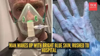 UK Man Wakes Up with Blue Skin, Panic Ensues Before Bedsheet Dye Revealed