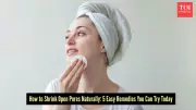 5 Natural Home Remedies to Reduce Trapped Pores and Improve Skin Texture