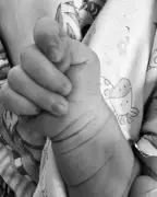 Chhattisgarh Infant Recovers from Severe Malnutrition After Timely District Intervention