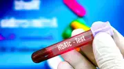 HbA1c vs Glucometer: Why the 3-Month Test Is Crucial for Diabetes Management
