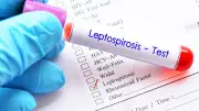 Karnataka Economic Survey Reveals Alarming Rise in Leptospirosis Cases