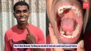 Malaysian Engineer Sets Guinness World Record with 42 Teeth