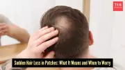 Sudden Bald Patches on Scalp: What Your Hair Loss Is Trying to Signal
