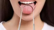 Your Tongue's Appearance Can Reveal Early Health Clues, Doctors Say