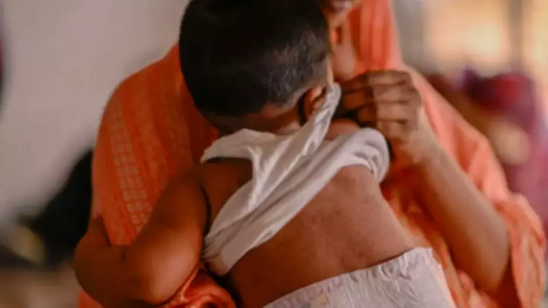 Bangladesh Launches Emergency Measles Vaccination Drive Amid Deadly Outbreak