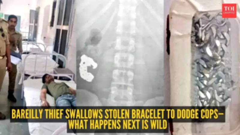 Bareilly Thief Swallows Stolen Bracelet, Police Recover It in Unusual Operation
