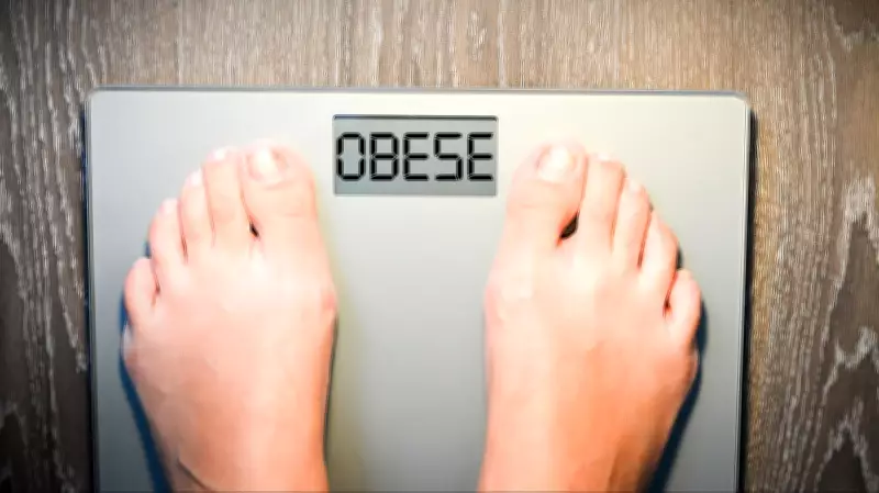 Bengaluru Study: Obesity in 30s Raises Diabetes and Heart Disease Risk