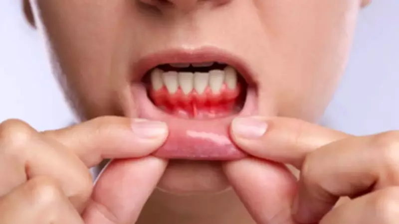 Bleeding Gums: A Silent Warning Sign for Heart and Kidney Health