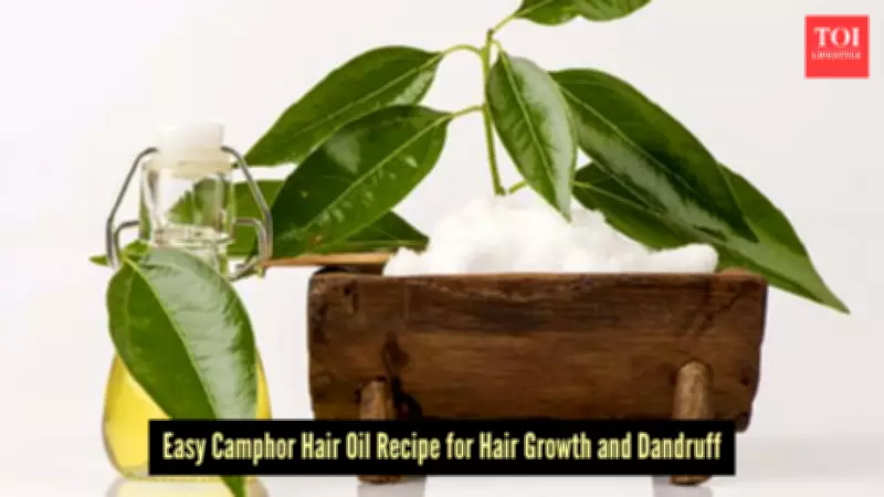 DIY Camphor Hair Oil: Beat Summer Dandruff and Itchy Scalp Naturally