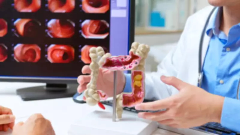 Gardner's Syndrome: The Silent Genetic Condition That Can Lead to Colon Cancer