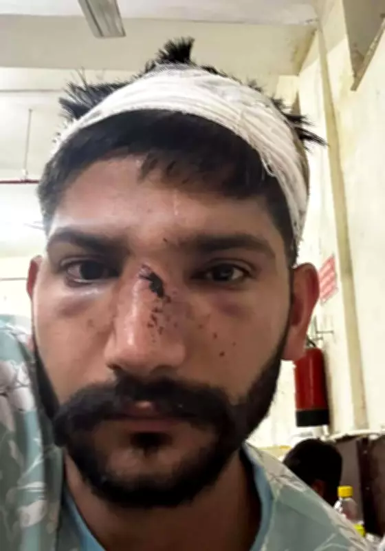 Gurgaon Carpenter, Brother Brutally Attacked After Agreeing to Testify in Court
