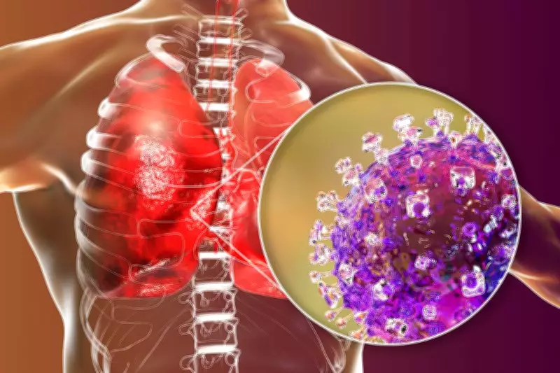 Haryana Government Expands Lung Disease Policy, Offers Rs 5 Lakh Aid to Workers